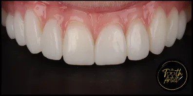 a10 Smile Gallery