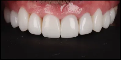 a11 Smile Gallery
