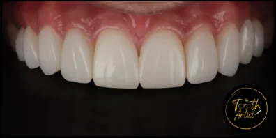 a12 Smile Gallery