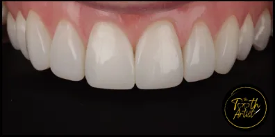 a13 Smile Gallery