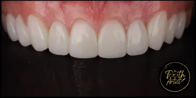 a5 Smile Gallery