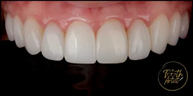 a6 Smile Gallery