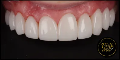 a7 Smile Gallery
