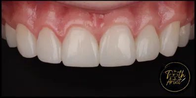 a8 Smile Gallery