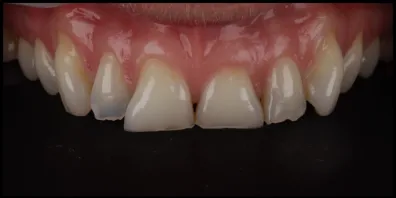 b10 Smile Gallery