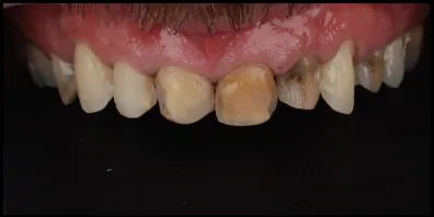 b11 Smile Gallery