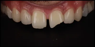 b12 Smile Gallery