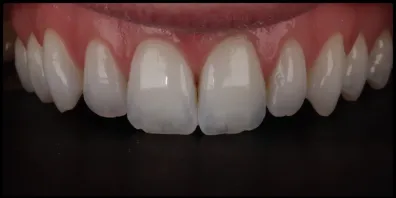 b13 Smile Gallery