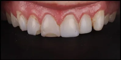 b5 Smile Gallery