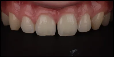 b8 Smile Gallery