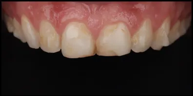 b9 Smile Gallery