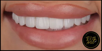Layer 1 8 Smile Gallery